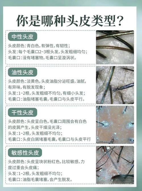 简短一点的护发小常识(日常护发小妙招)-第5张图片-牛逼常识网 简短一点的护发小常识(日常护发小妙招)-第5张图片-牛逼常识网