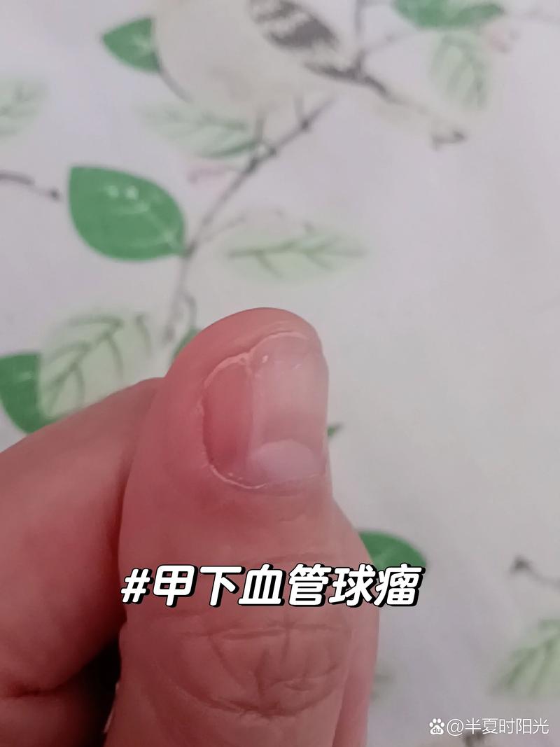 毛细血管常识(毛细血管五大特点)-第3张图片-牛逼常识网 毛细血管常识(毛细血管五大特点)-第3张图片-牛逼常识网