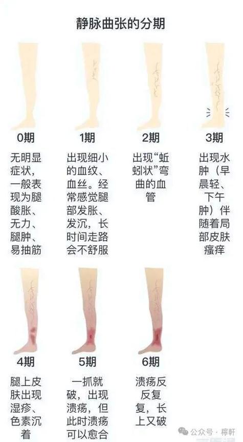 毛细血管常识(毛细血管五大特点)-第6张图片-牛逼常识网 毛细血管常识(毛细血管五大特点)-第6张图片-牛逼常识网