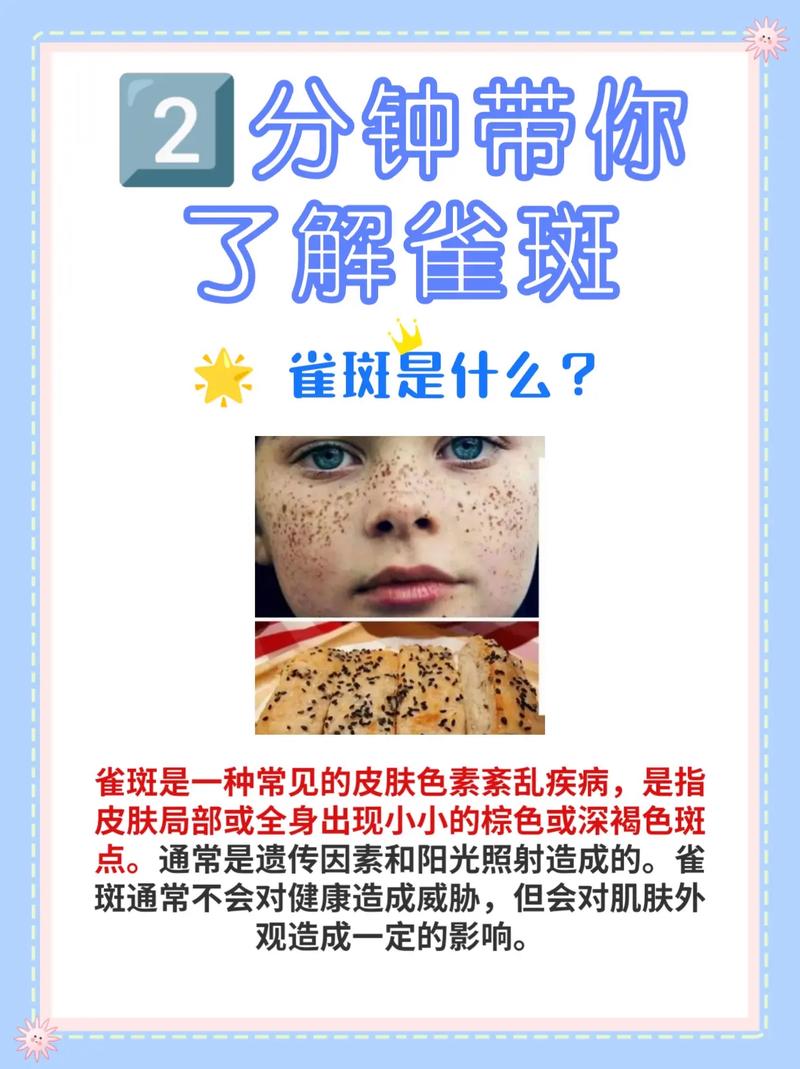 去斑小知识（祛斑小知识你了解吗）