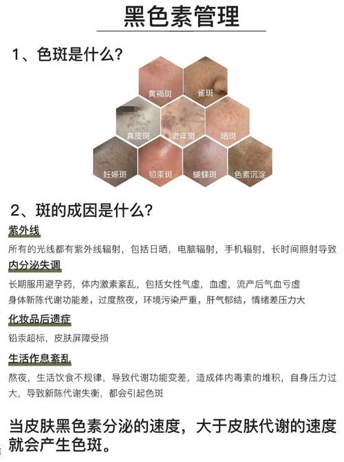 科普祛斑常识(科普祛斑常识有哪些)-第4张图片-牛逼常识网 科普祛斑常识(科普祛斑常识有哪些)-第4张图片-牛逼常识网
