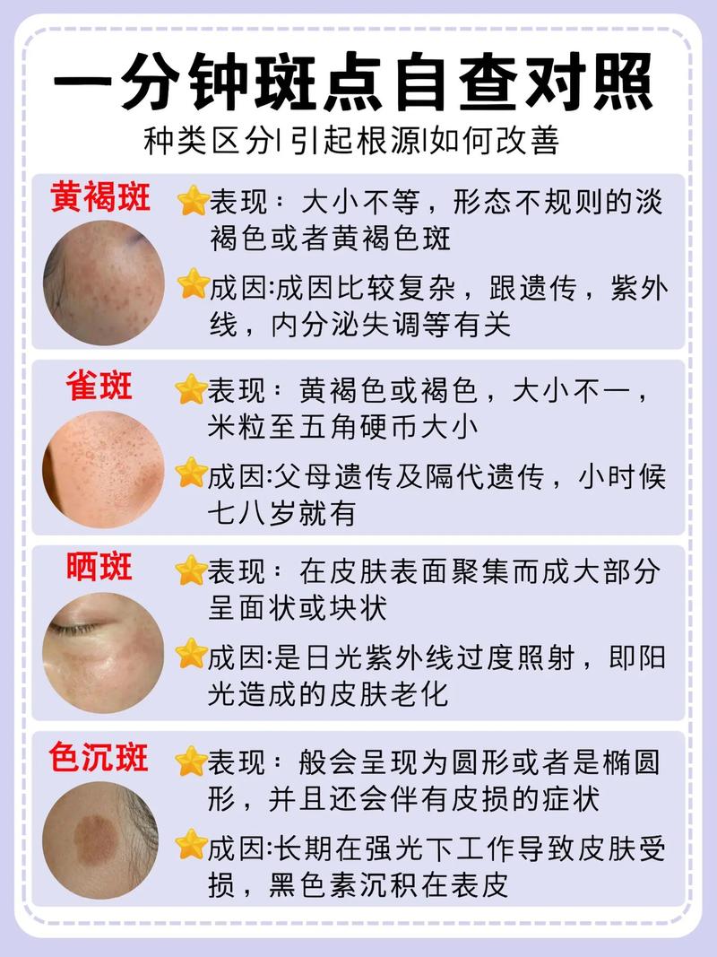 科普祛斑常识(科普祛斑常识有哪些)-第5张图片-牛逼常识网 科普祛斑常识(科普祛斑常识有哪些)-第5张图片-牛逼常识网