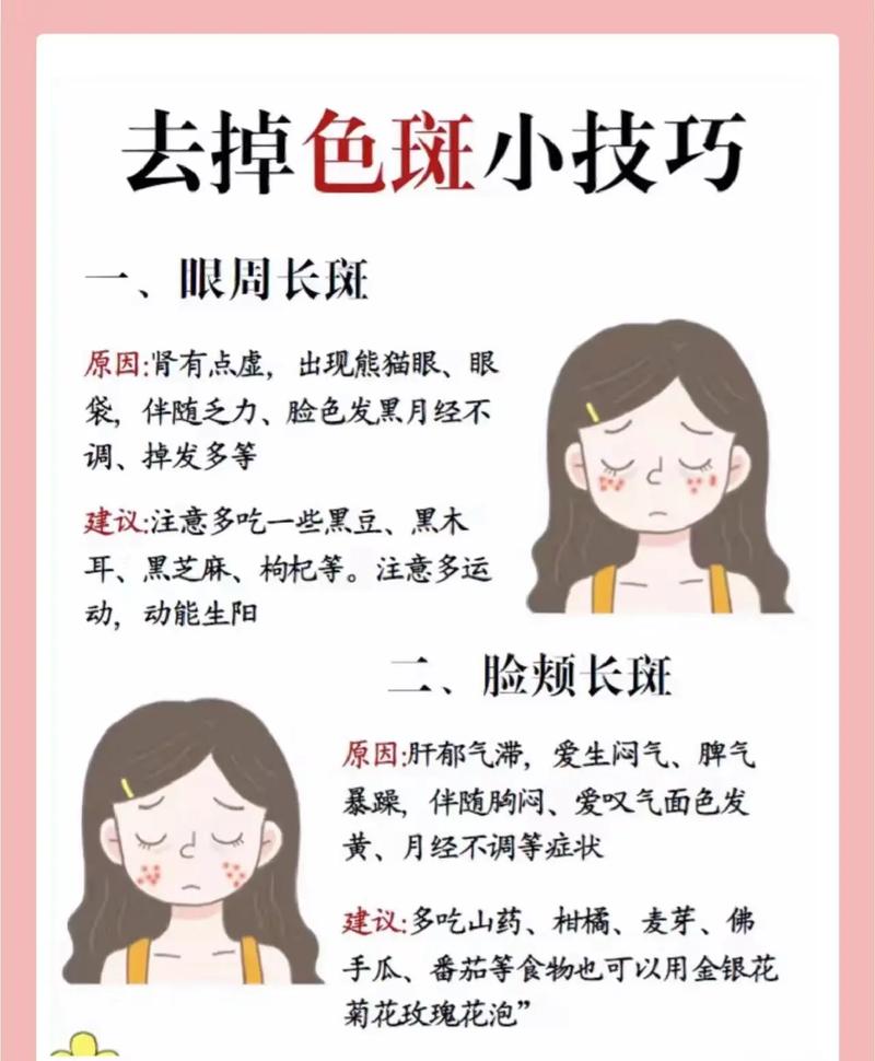 科普祛斑常识(科普祛斑常识有哪些)-第6张图片-牛逼常识网 科普祛斑常识(科普祛斑常识有哪些)-第6张图片-牛逼常识网