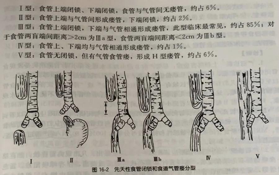 常识改变术式(常识改变术式名词解释)-第6张图片-牛逼常识网 常识改变术式(常识改变术式名词解释)-第6张图片-牛逼常识网