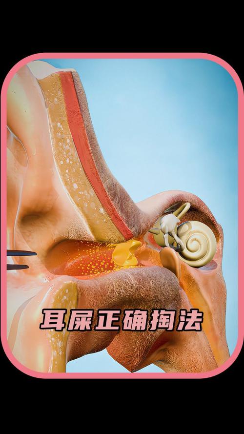 抠耳朵小常识,抠耳朵小常识大全-第6张图片-牛逼常识网 抠耳朵小常识,抠耳朵小常识大全-第6张图片-牛逼常识网