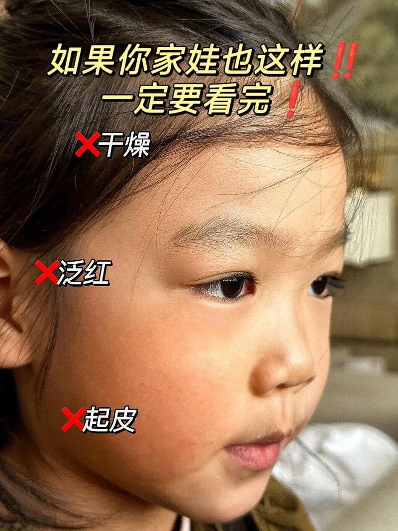 儿童护肤常识(儿童护肤的重要性)-第4张图片-牛逼常识网 儿童护肤常识(儿童护肤的重要性)-第4张图片-牛逼常识网